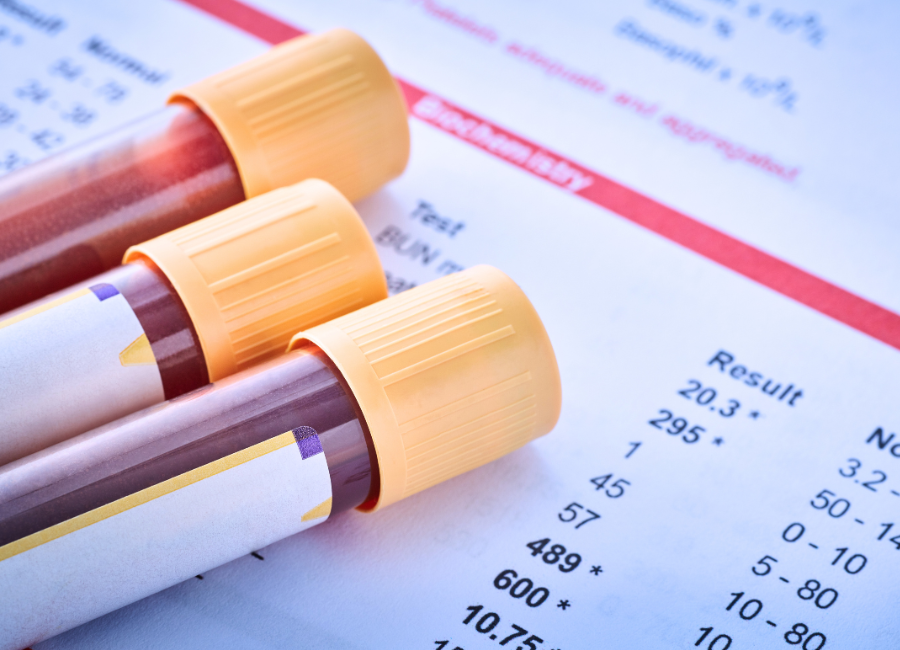 Etobicoke Comprehensive Testing at One Health Services